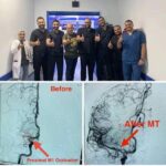 إجراء قسطرة مخيه طارئه بعد منتصف الليل بمستشفى المنصوره التخصصي